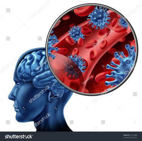 Virus Brain Infection Chart Infecting Blood Stock Illustration 73319488