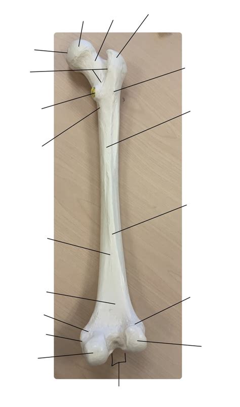 Femur Landmark Posterior Diagram Quizlet