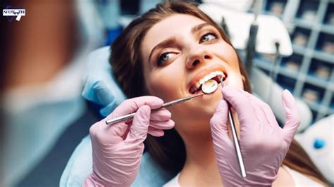 What Is Direct Bonding Teeth? - Infoteeth