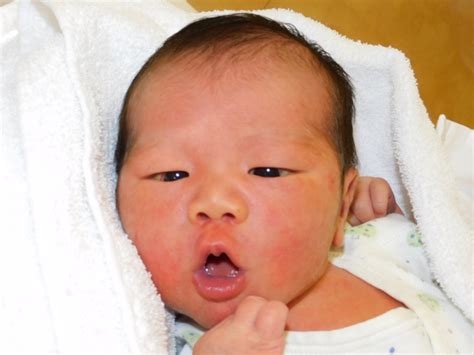 令和4年3月21日 日本海病院産婦人科