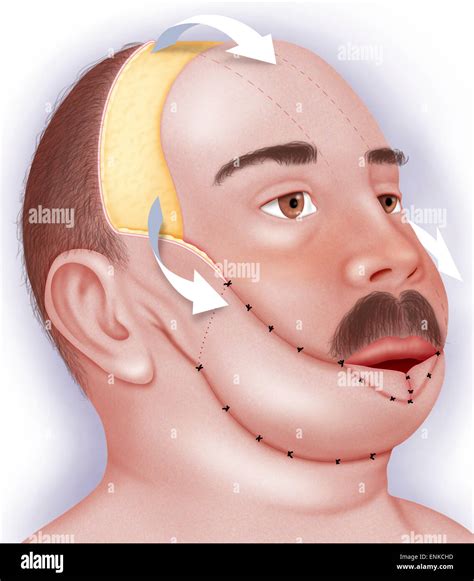 Traumatismo Bucal Fotograf As E Im Genes De Alta Resoluci N Alamy