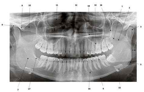 Anatomische Structuren Opg Diagram Quizlet