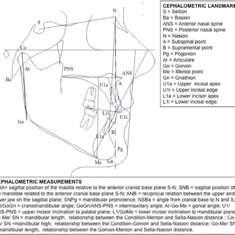 Skeletal Angular Cephalometric Measurements 1 Sna 2 Snb 3 Anb 4 Download Scientific