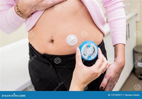 Doctor Install Patient Insulin Catheter For A Simple Injection Of Insulin Stock Image Image