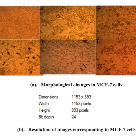 A Morphological Changes In Mcf Cells Resolution Of Images