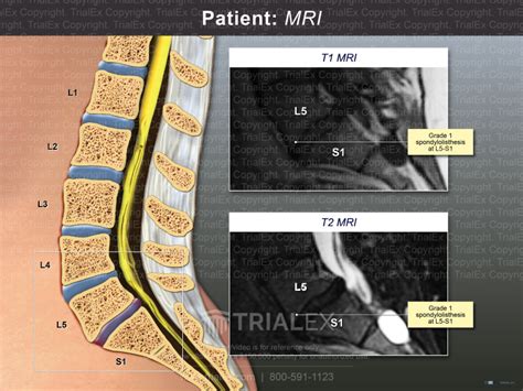 Patient Mri Trialquest Inc