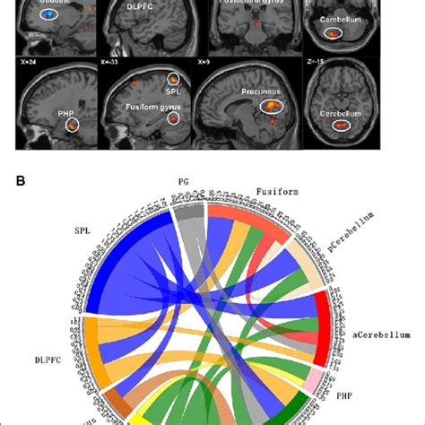 Functional Magnetic Resonance Imaging Fmri Results With Significant Download Scientific