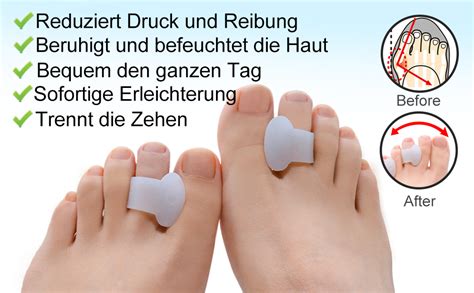 Welnove Zehentrenner Gel Zehenspreizer Kleine Bunion Korrektur Zur