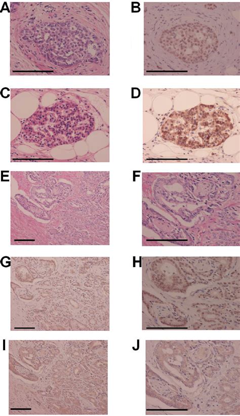 Figure 1 From Immunohistochemical Analysis Of Gastrin Releasing Peptide