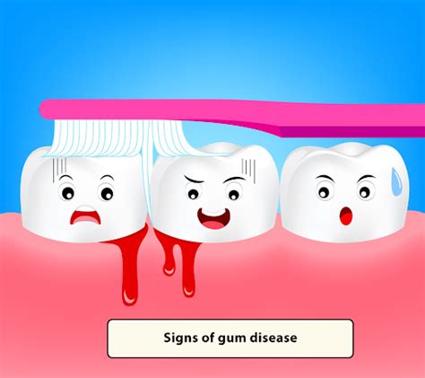 Signs Of Gum Disease - Dr Ann Chernyak