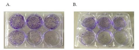 Colony Formation Assay Of Hct116 A And Sw48 B At 18th Day After Download Scientific Diagram