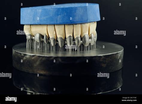 Tooth Dental Crowns Created On D Printer For Metal Gypsum Model On A