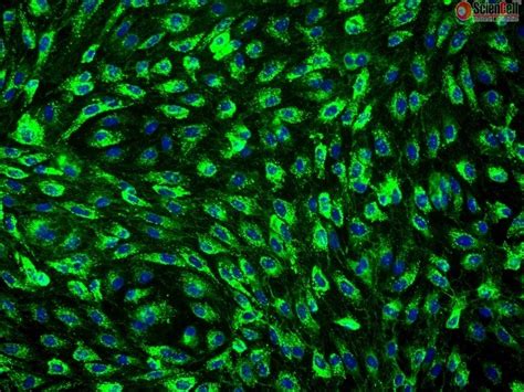 Human Mammary Microvascular Endothelial Cells