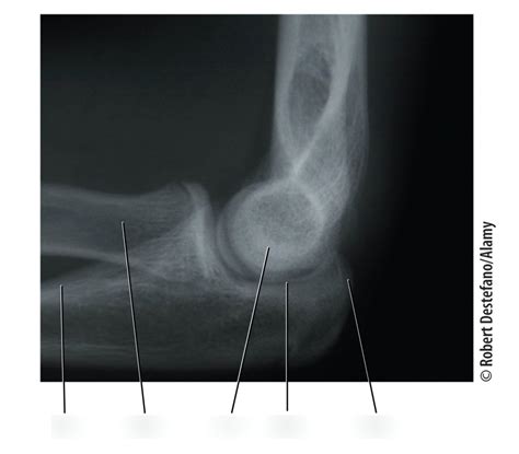 Elbow Xray Labeling Diagram Quizlet