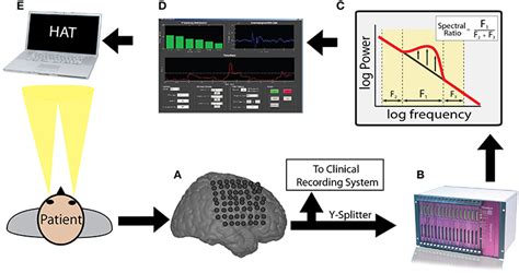 Brain computer interface free recall task: overview. Incoming ECoG data ...