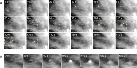 dynamics  living fibroblast cell surface revealed  high speed afm