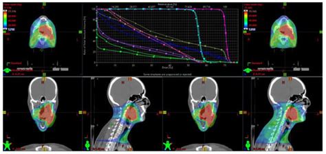 Cancers Free Full Text Ultra High Dose Rate Transmission Beam Proton Therapy For