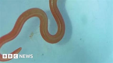 Live Worm Found In Australian Woman S Brain In World First Bbc News