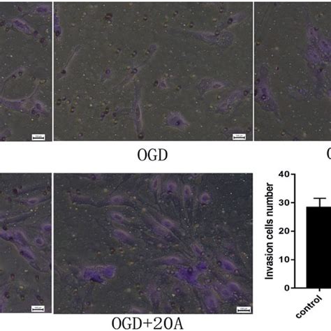 Effects Of Alisol A Acetate On Invasion Capabilities Invasion