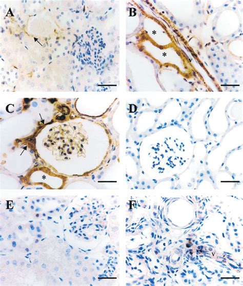 Angiopoietin 1 Ang 1 Immunohistochemical Staining In Renal Cortex