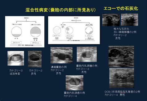 乳がん健診を識る｜ひふみクリニック 埼玉県川口市東領家の内科乳腺外科外科皮膚科総合診断