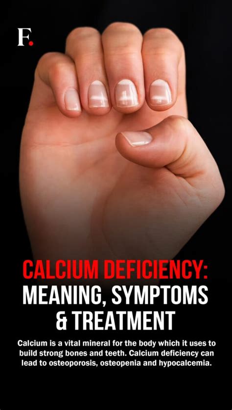 Calcium Deficiency: Symptoms and Treatment