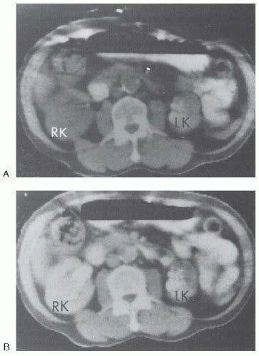 C27-FF13.gif | Abdominal Key