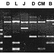 PCR RFLP Analysis Of A Randomly Selected Subset Of The Ssu RDNA Clones