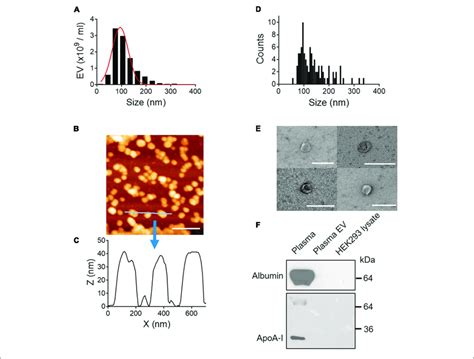 Physical And Biochemical Characterization Of Evs Isolated From