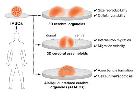 | 3D brain organoids for modeling human brain development and ...