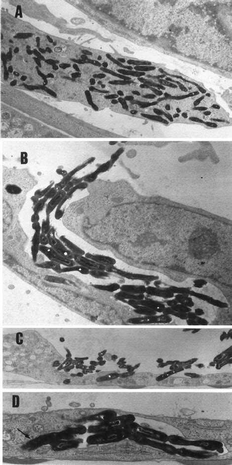 M Abscessus R Multiplies Extensively Within Human Fibroblasts And