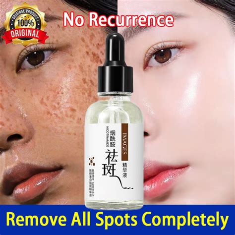 Whitening Serum Freckles Remove Dark Spots Serum Esens Anti Flek Bintik