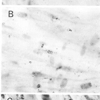 In Situ Hybridization Of HSV 2 3H DNA To HCMV Superinfected Quiescent