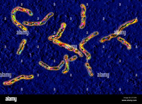 Mycobacterium Tuberculosis Microscope Stock Photos & Mycobacterium Tuberculosis Microscope Stock ...