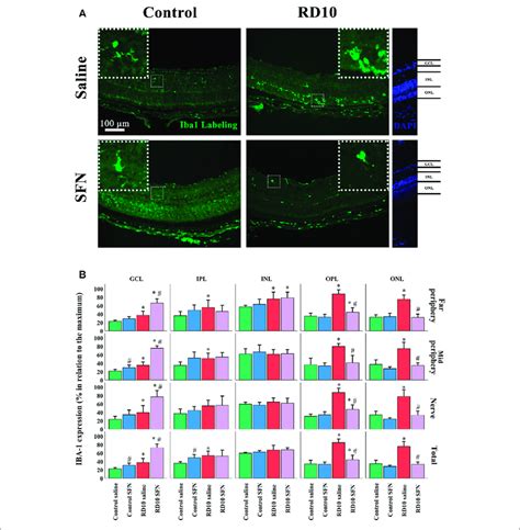 Microglia Phenotype Analysis A Nerve Region Images Of Iba