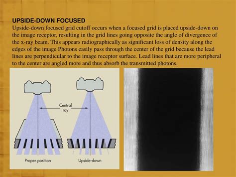 Ppt Radiographic Grids Ii Powerpoint Presentation Free Download Id