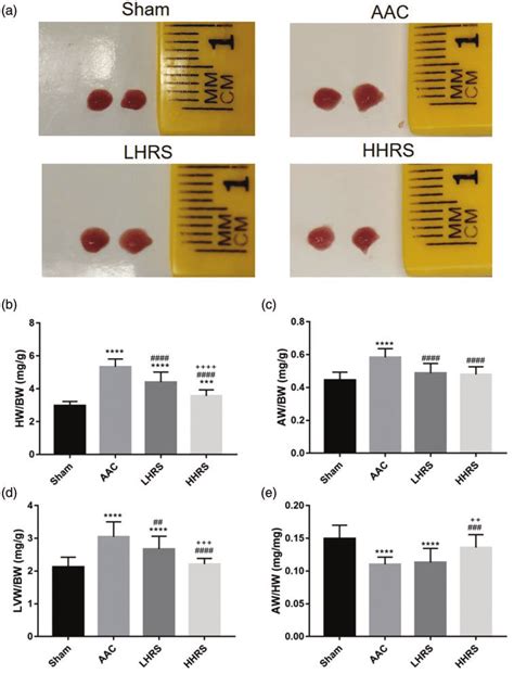 Cardiac Hypertrophy In The Rat Abdominal Aortic Constriction AAC