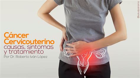 Cáncer Cervicouterino Causas Síntomas Y Tratamiento Youtube