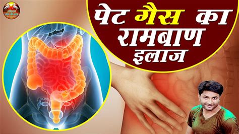 पट क गस क रमबण इलज How To Cure Stomach Gas pet ki gas ka