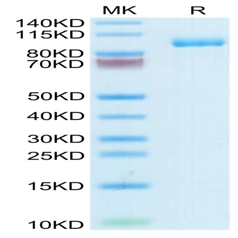 Human Thyroid Peroxidase Protein Tpo Hm Kactus Biosystems Ushelf