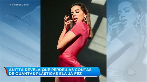 Anitta Fala Sobre Pl Sticas E Diz Que J Perdeu As Contas De Quantas