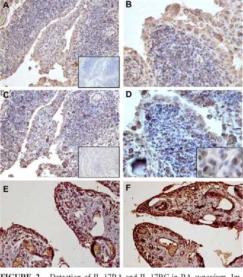 Figure 2 From Il 17ra And Il 17rc Receptors Are Essential For Il 17a