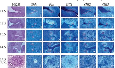 Figure From The Shh Signalling Pathway In Tooth Development Defects