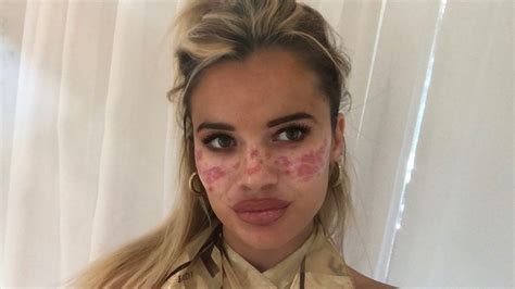 A DIY TikTok Beauty Hack Catastrophe Led Australian TV Star To The ...