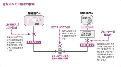 ホルモン依存型の乳がんのホルモン療法