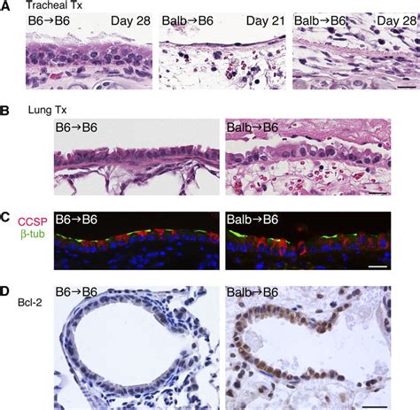 Airway Epithelial Cell Differentiation In Heterotopic Tracheal And