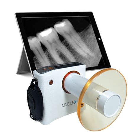 Sistema de radiografía intraoral MobileX Denterprise portátil