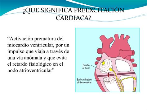 Sindrome De Wolff Parkinson White Ppt