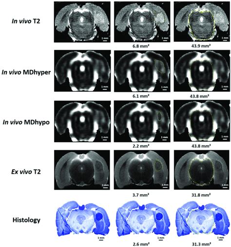 In Vivo Mri Ex Vivo Mri And Histological Analysis In Gb In This