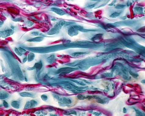 Photograph | Thin Skin, Collagen and Elastic Fibers | Science Source Images